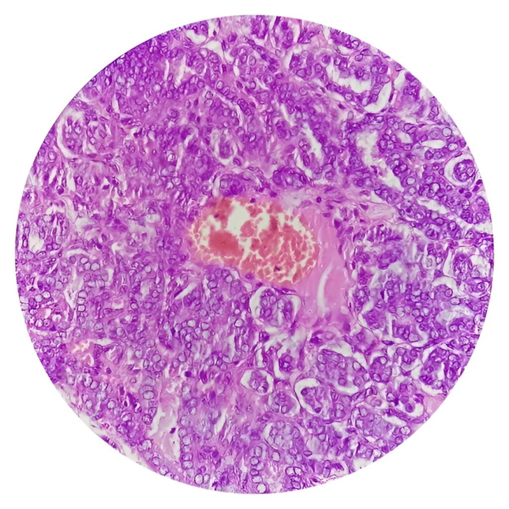Head and neck cancer microscopy
